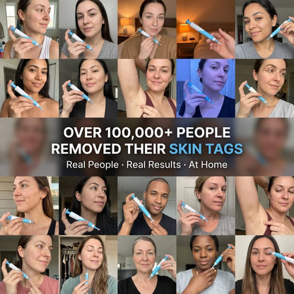 7-Days Skin Tag Care Kit A simple at-home solution for small skin tags — no creams, no complicated steps.